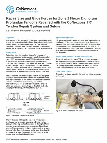 Repair Size and Glide Forces for Zone 2 Flexor Digitorum Profundus Tendons Repaired with the CoNextions TR® Tendon Repair System and Suture